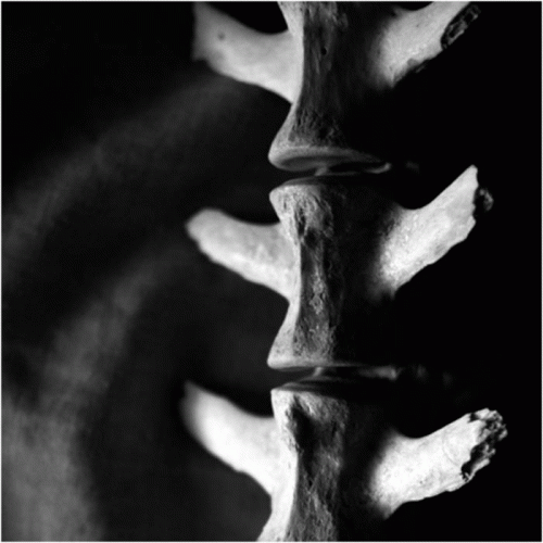 Negativa (ESP) : MMXIII